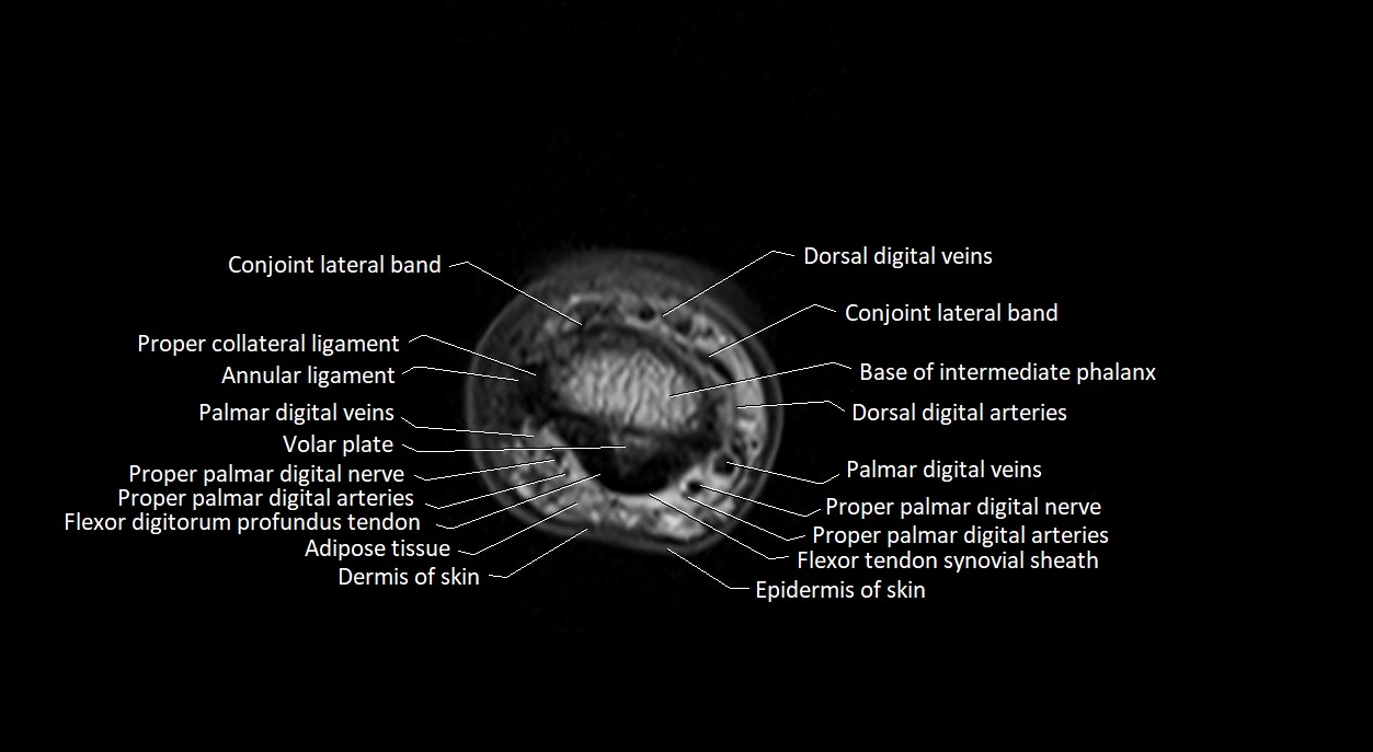 Finger anatomy axial cross sectional 3T image image 11.webp